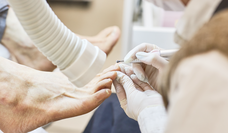 Forsy Nail Hifuss Garosugil Branch