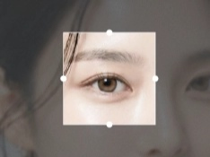 Samsung Miracle Eye Clinic × iipuda Exclusive Deal | One-Day Fast Track